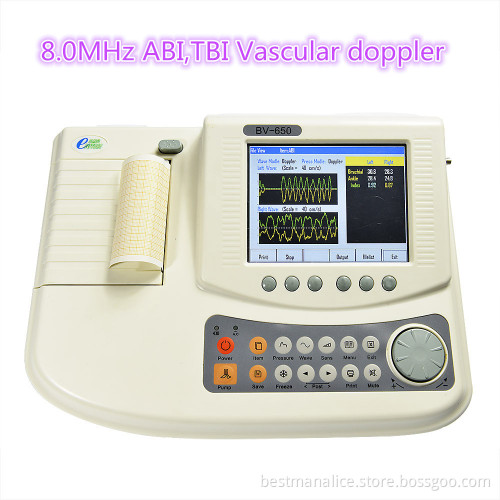vascular doppler